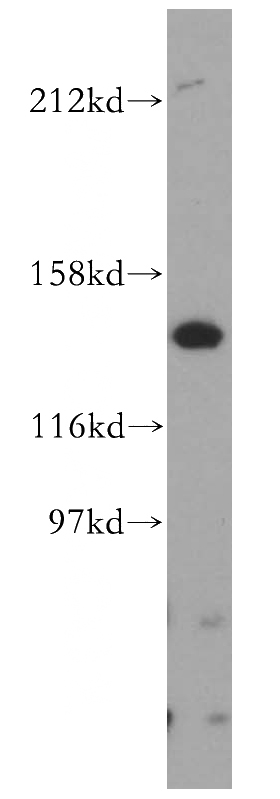 Jurkat cells were subjected to SDS PAGE followed by western blot with Catalog No:113725(PEX1 antibody) at dilution of 1:500