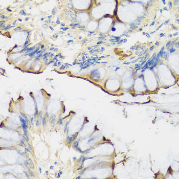 Immunohistochemistry - CRTAP Polyclonal Antibody 