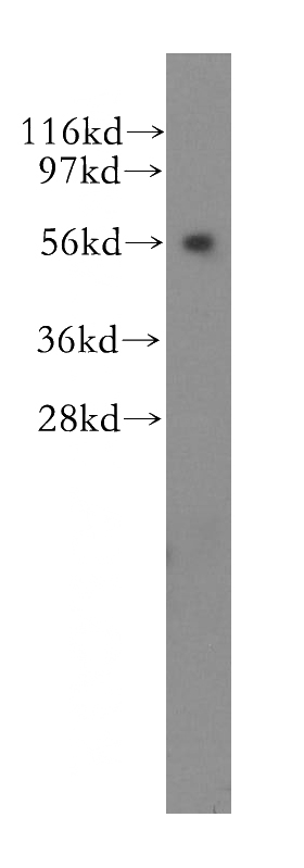 human liver tissue were subjected to SDS PAGE followed by western blot with Catalog No:112075(KLC3 antibody) at dilution of 1:500