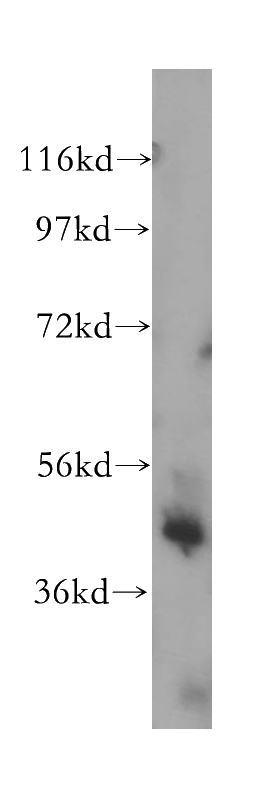 human heart tissue were subjected to SDS PAGE followed by western blot with Catalog No:110613(FECH antibody) at dilution of 1:500