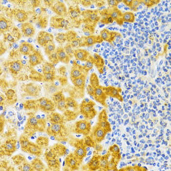 Immunohistochemistry - EDA Polyclonal Antibody 