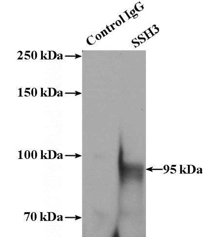 IP Result of anti-SSH3 (IP:Catalog No:115608, 4ug; Detection:Catalog No:115608 1:1000) with A431 cells lysate 2800ug.