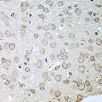 Immunohistochemistry - CDH11 Polyclonal Antibody 