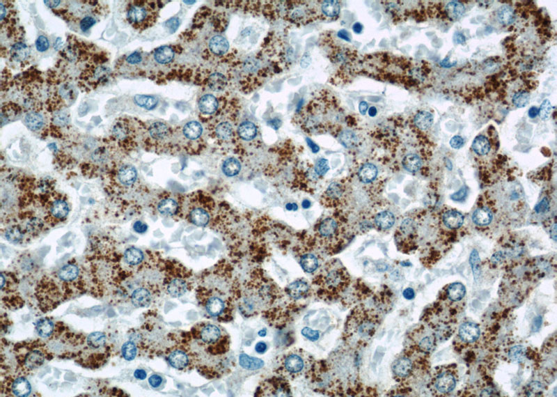 Immunohistochemical of paraffin-embedded human liver using Catalog No:111788(INE1 antibody) at dilution of 1:50 (under 40x lens)