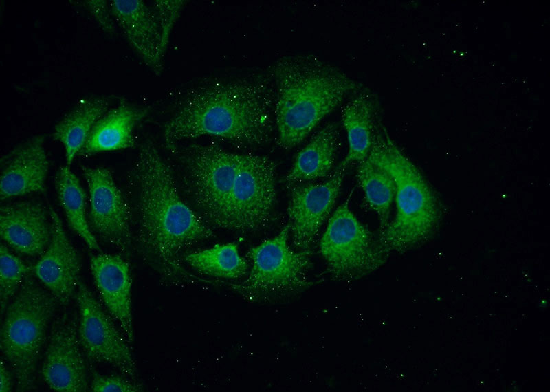 Immunofluorescent analysis of SH-SY5Y cells using Catalog No:113162(NEFL Antibody) at dilution of 1:50 and Alexa Fluor 488-congugated AffiniPure Goat Anti-Rabbit IgG(H+L)