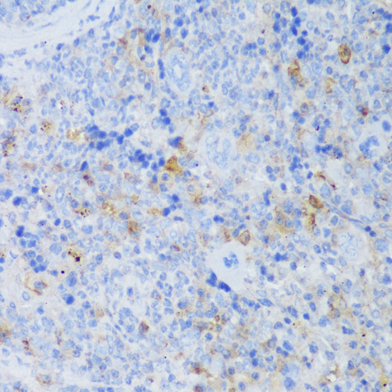 Immunohistochemistry - EFHD2 Polyclonal Antibody 