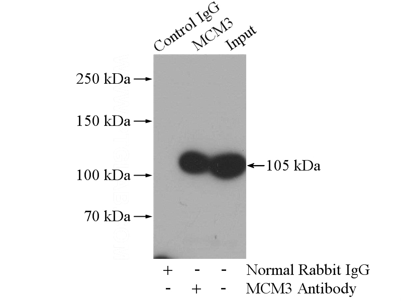 IP Result of anti-MCM3 (IP:Catalog No:112553, 4ug; Detection:Catalog No:112553 1:500) with HeLa cells lysate 1400ug.