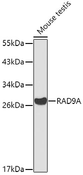Western blot - RAD9A Polyclonal Antibody 