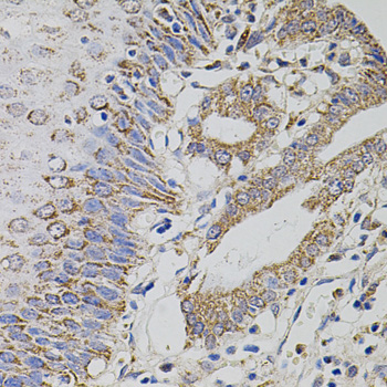 Immunohistochemistry - TRMT2A Polyclonal Antibody 