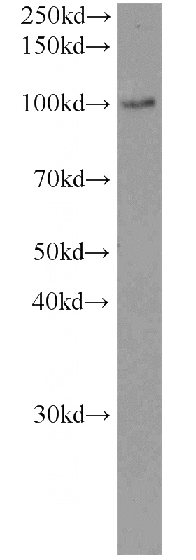 mouse testis tissue were subjected to SDS PAGE followed by western blot with Catalog No:112214(LHCGR antibody) at dilution of 1:500