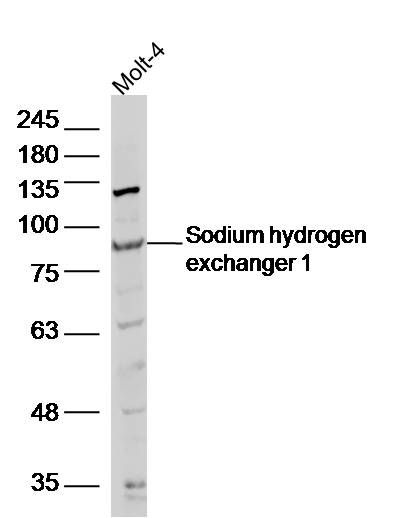 Fig3: Sample:; molt-4(human)cell Lysate at 40 ug; Primary: Anti- Sodium hydrogen exchanger 1 at 1/300 dilution; Secondary: IRDye800CW Goat Anti-Rabbit IgG at 1/20000 dilution; Predicted band size: 91kD; Observed band size: 91 kD