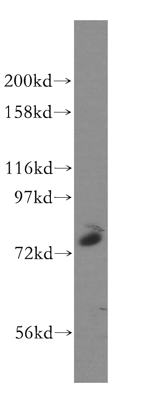 HeLa cells were subjected to SDS PAGE followed by western blot with Catalog No:110848(GALNT7 antibody) at dilution of 1:800