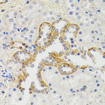 Immunohistochemistry - SH2B1 Polyclonal Antibody 