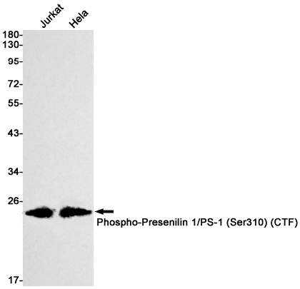 Western blot detection of Phospho-Presenilin 1/PS-1 (Ser310) in Jurkat,Hela cell lysates using Phospho-Presenilin 1/PS-1 (Ser310) Rabbit mAb(1:1000 diluted).Predicted band size:53kDa.Observed band size:22kDa.