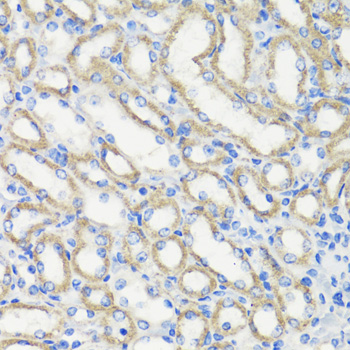 Immunohistochemistry - DEPDC6 Polyclonal Antibody 