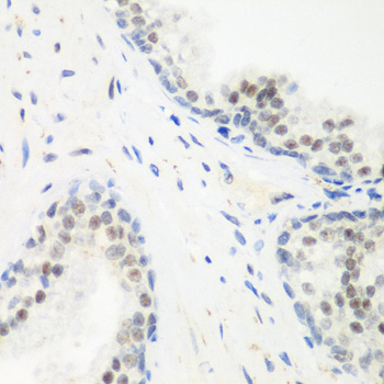 Immunohistochemistry - PPAN Polyclonal Antibody 