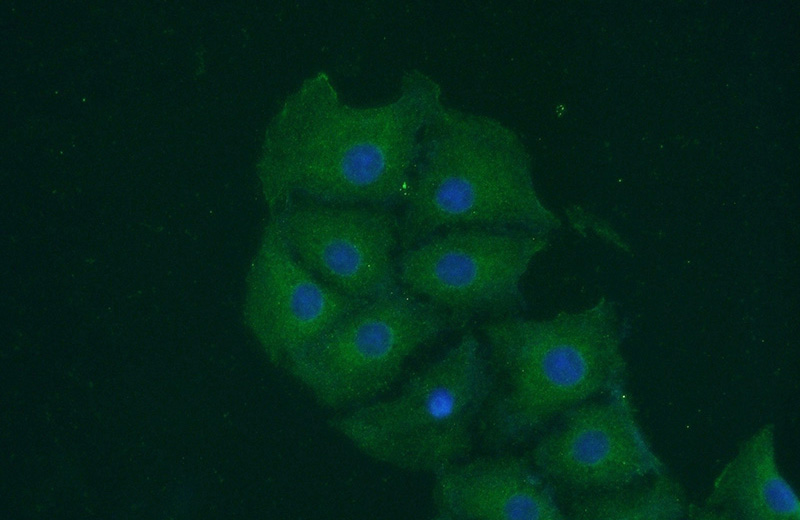 Immunofluorescent analysis of SH-SY5Y cells using Catalog No:109984(DKK3 Antibody) at dilution of 1:50 and Alexa Fluor 488-congugated AffiniPure Goat Anti-Rabbit IgG(H+L)