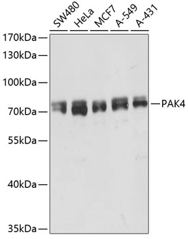 Western blot - PAK4 Polyclonal Antibody 