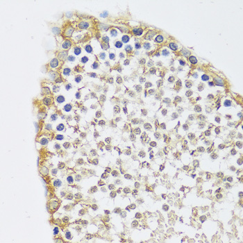 Immunohistochemistry - C12orf10 Polyclonal Antibody 