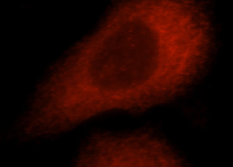 Immunofluorescent analysis of MCF-7 cells, using OPTN antibody Catalog No:113415 at 1:25 dilution and Rhodamine-labeled goat anti-rabbit IgG (red).