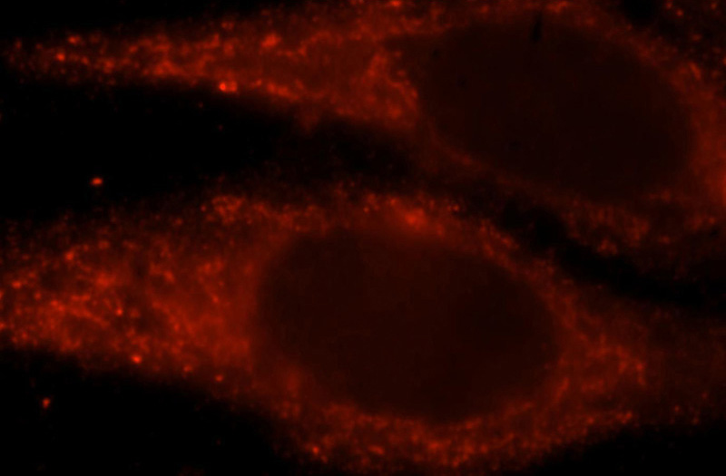 Immunofluorescent analysis of HepG2 cells, using CS antibody Catalog No:109325 at 1:25 dilution and Rhodamine-labeled goat anti-rabbit IgG (red).