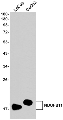 Western blot detection of NDUFB11 in LnCap,CaCo2 cell lysates using NDUFB11 Rabbit pAb(1:1000 diluted).Predicted band size:17KDa.Observed band size:17KDa.