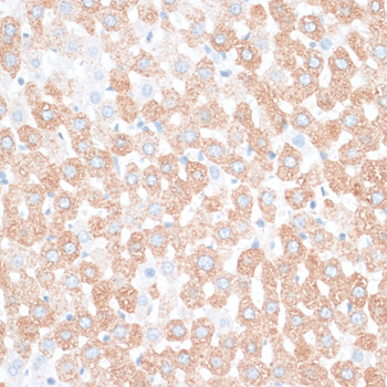 Immunohistochemistry - HMGA2 Polyclonal Antibody 