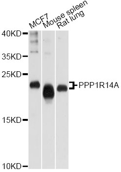 Western blot - PPP1R14A Polyclonal Antibody 