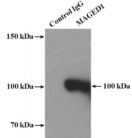IP Result of anti-MAGED1 (IP:Catalog No:112390, 4ug; Detection:Catalog No:112390 1:1000) with A549 cells lysate 400ug.