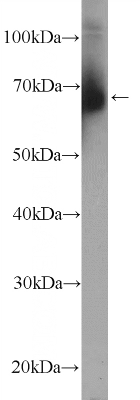 mouse testis tissue were subjected to SDS PAGE followed by western blot with Catalog No:117044(ZFP90 Antibody) at dilution of 1:600
