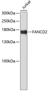 Western blot - FANCD2 Polyclonal Antibody 