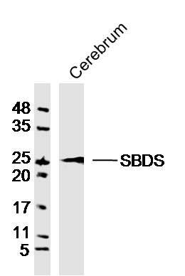 Fig2: Sample:Cerebrum (Rat)Lysate at 40 ug; Primary: Anti-GCAP1 at 1/300 dilution; Secondary: IRDye800CW Goat Anti-RabbitIgG at 1/20000 dilution; Predicted band size: 23kD; Observed band size: 23kD