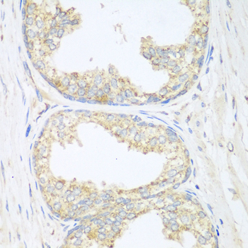 Immunohistochemistry - SGCB Polyclonal Antibody 