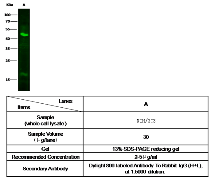 MMP-8 / CLG1 Antibody, Rabbit PAb, Antigen Affinity Purified, Western blot