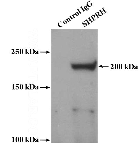 IP Result of anti-SHPRH (IP:Catalog No:115282, 4ug; Detection:Catalog No:115282 1:300) with mouse testis tissue lysate 4000ug.