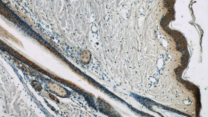Immunohistochemistry of paraffin-embedded human skin slide using Catalog No:113873(PIK3CB Antibody) at dilution of 1:50