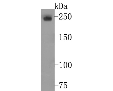 Fig1:; Western blot analysis of LY75 on THP-1 cell lysates. Proteins were transferred to a PVDF membrane and blocked with 5% BSA in PBS for 1 hour at room temperature. The primary antibody ( 1/500) was used in 5% BSA at room temperature for 2 hours. Goat Anti-Rabbit IgG - HRP Secondary Antibody (HA1001) at 1:200,000 dilution was used for 1 hour at room temperature.