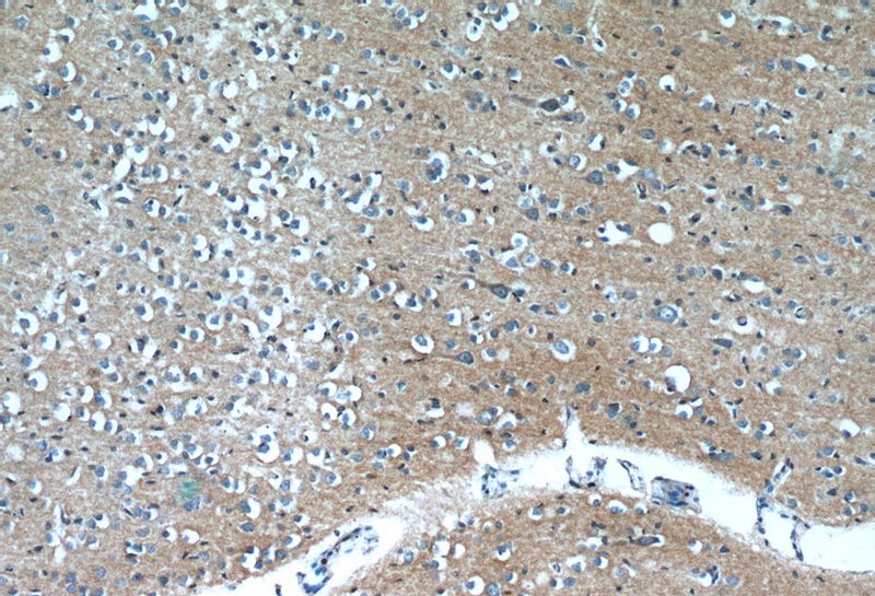 Immunohistochemistry of paraffin-embedded human brain slide using Catalog No:107440(OXA1L Antibody) at dilution of 1:50