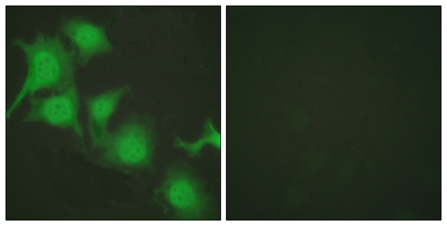 Immunofluorescence analysis of HUVEC cells, using Nrf2 Antibody. The picture on the right is blocked with the synthesized peptide.