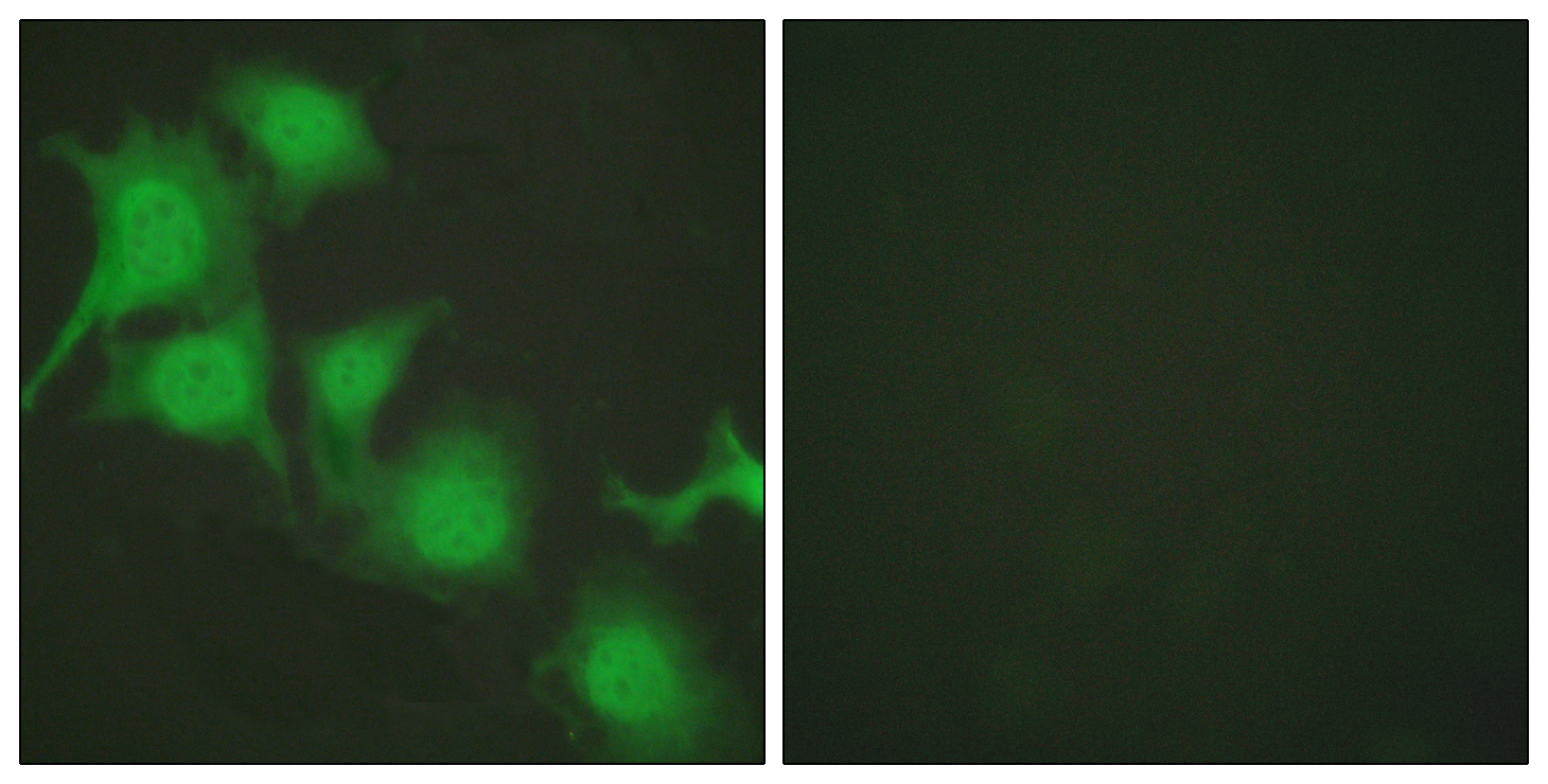 Immunofluorescence analysis of HUVEC cells, using Nrf2 Antibody. The picture on the right is blocked with the synthesized peptide.