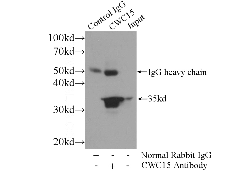 IP Result of anti-CWC15 (IP:Catalog No:109630, 3ug; Detection:Catalog No:109630 1:600) with HeLa cells lysate 2800ug.