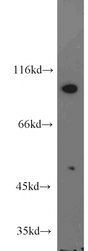 mouse testis tissue were subjected to SDS PAGE followed by western blot with Catalog No:112050(KIF6 antibody) at dilution of 1:800
