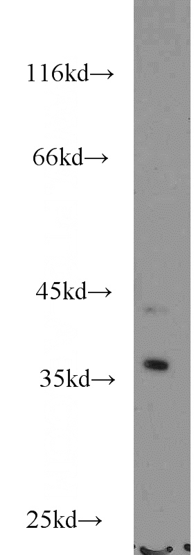 MCF7 cells were subjected to SDS PAGE followed by western blot with Catalog No:113093(NECAP2 antibody) at dilution of 1:600