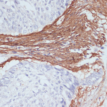 Immunohistochemistry - COL1A1 Polyclonal Antibody 
