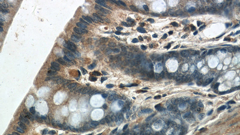 Immunohistochemistry of paraffin-embedded rat colon tissue slide using Catalog No:114056(POM121 Antibody) at dilution of 1:50 (under 40x lens)