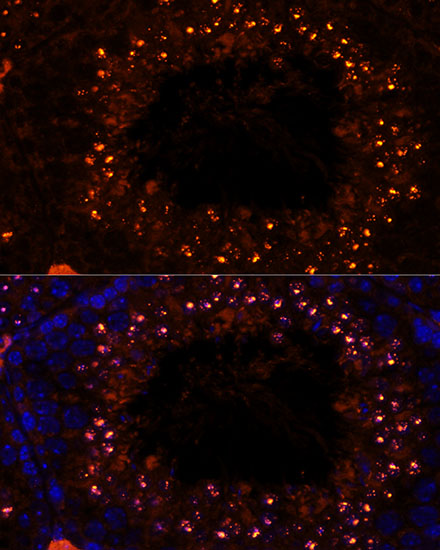 Immunofluorescence - MSH4 Polyclonal Antibody 