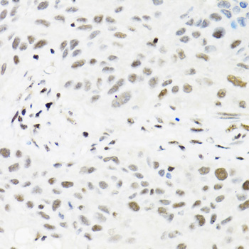 Immunohistochemistry - TRMT2A Polyclonal Antibody 