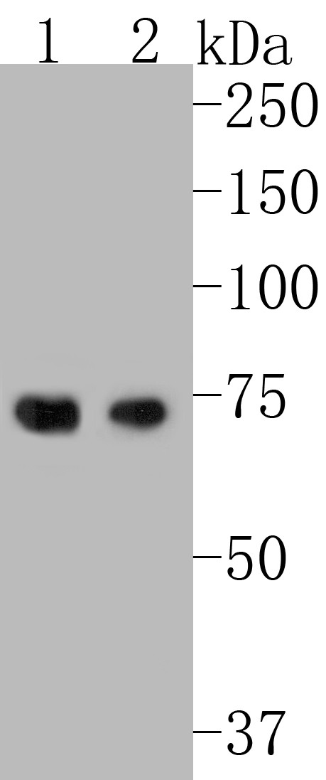 Fig1:; Western blot analysis of HDG11 on HDG11 recombinant protein. Proteins were transferred to a PVDF membrane and blocked with 5% BSA in PBS for 1 hour at room temperature. The primary antibody was used in 5% BSA at room temperature for 2 hours. Goat Anti-Rabbit IgG - HRP Secondary Antibody (HA1001) at 1:5,000 dilution was used for 1 hour at room temperature.; Positive control:; Lane 1: HDG11 recombinant protein with primary antibody at 1:200 dilutions; Lane 2: HDG11 recombinant protein with primary antibody at 1:1,000 dilutions
