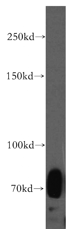 HL-60 cells were subjected to SDS PAGE followed by western blot with Catalog No:115287(SIGLEC5 antibody) at dilution of 1:500