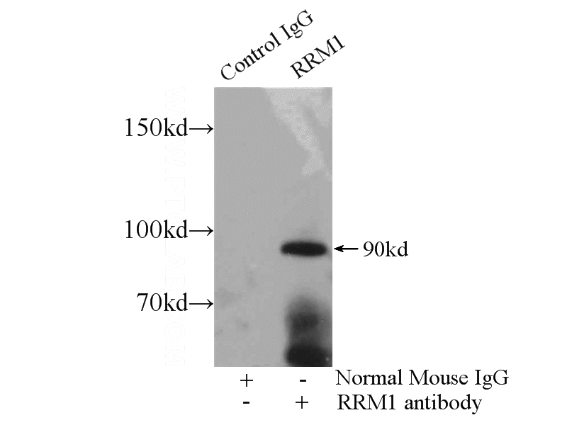 IP Result of anti-RRM1 (IP:Catalog No:107511, 5ug; Detection:Catalog No:107511 1:1000) with K-562 cells lysate 3200ug.